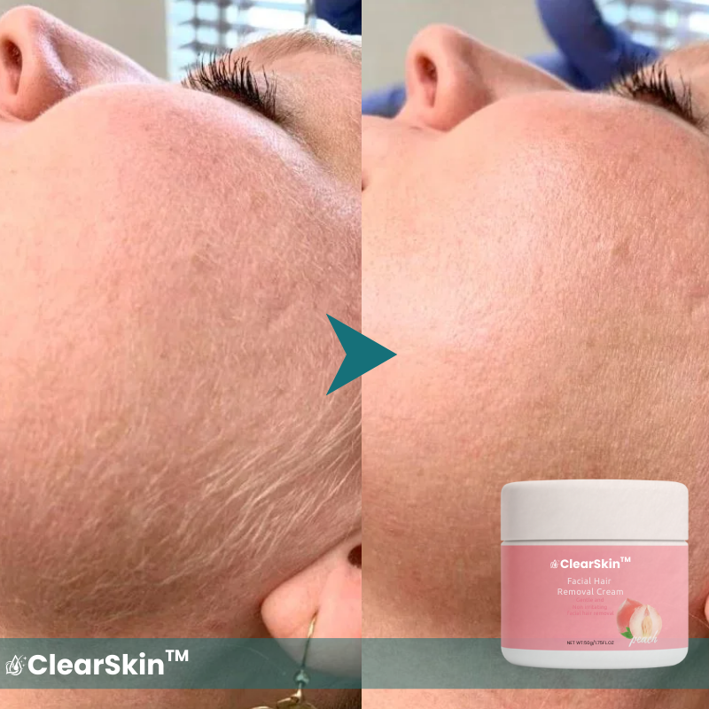 ClearSkin™ Facial Hair Eraser